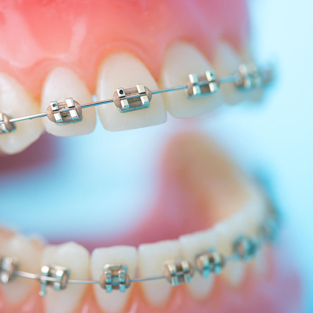 矯正治療を専門に学んだ歯科医師が、小児矯正・成人矯正を行います